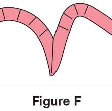 Needle-turn Applique Figure F